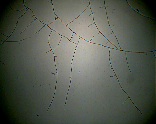 Asterostroma laxum Bres. (1920)